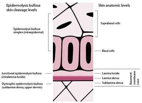 epidermolisi bollosa livelli cutanei